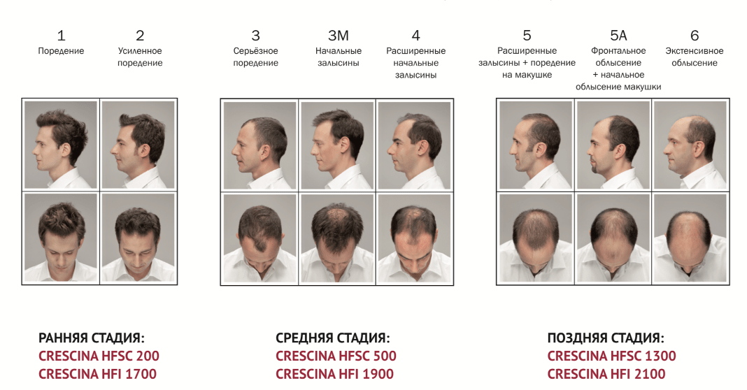 Что отвечает за рост волос на лице у мужчин