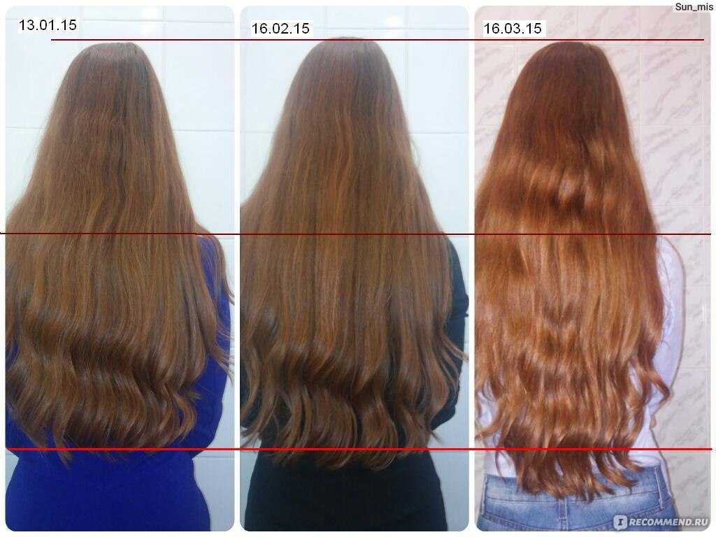 Как усилить рост волос. Ускорение роста волос. Ускорение роста волос на голове. Увеличить рост волос. Ускорить рост волос.