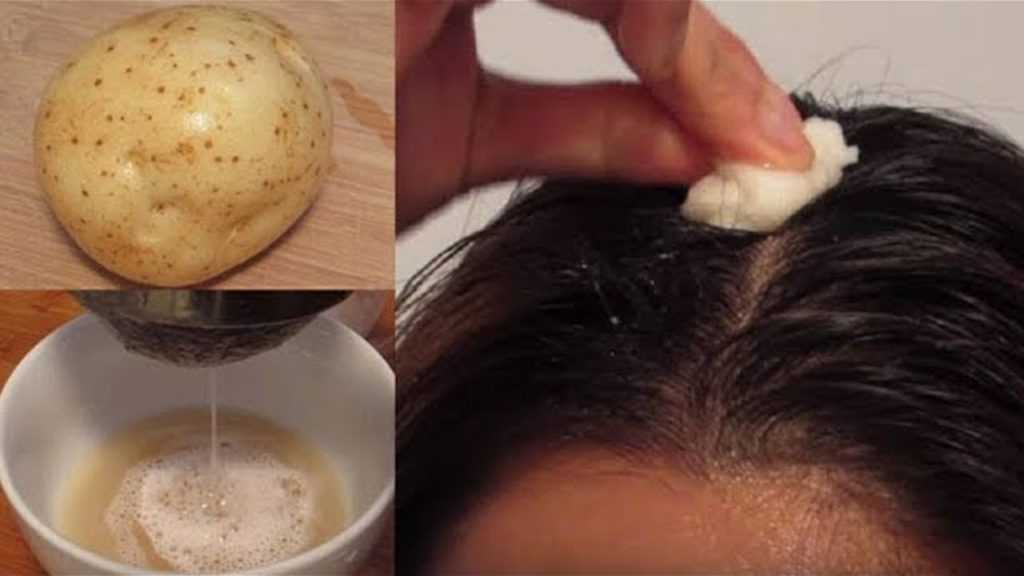 Сколько должно быть волос на голове в одной луковице