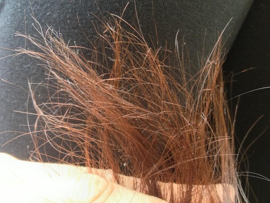 Сильно сухой волос. Узловатая трихоклазия. Узелковая трихоклазия волос. Сеченые кончики волос. Секущиеся кончики.