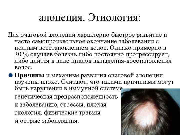 Отзывы врачей выпадение волос. Очаговая алопеция этиология патогенез. Мази пригнездной алоаеции. Очаговая (гнездная) алопеция. Выпадение волос алопеция.