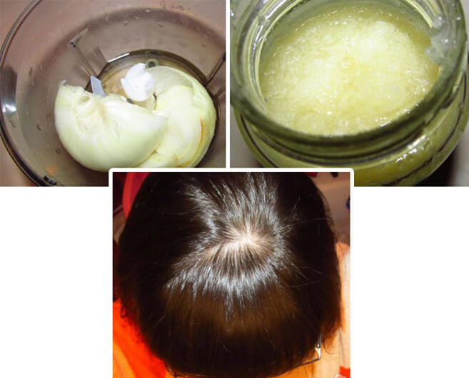 Как восстановить рост волос на голове у женщин народными средствами