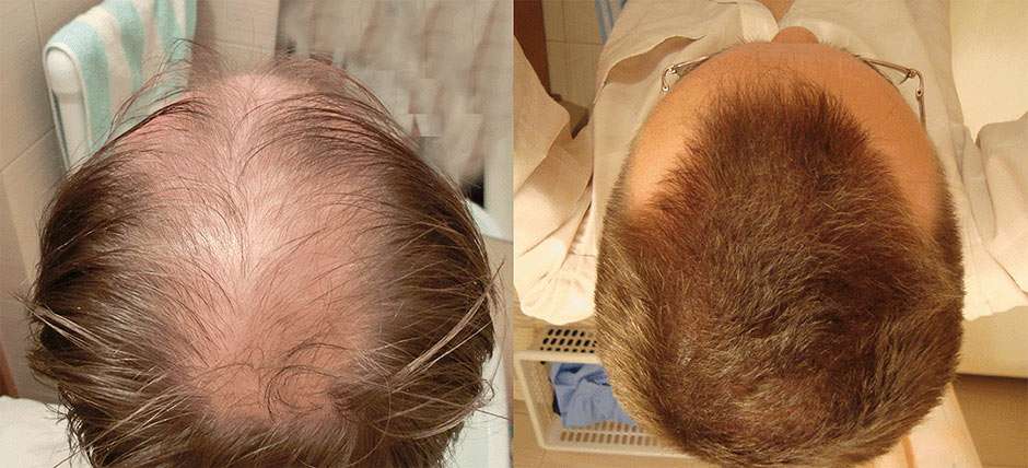 Как понять что на голове растут новые волосы на голове